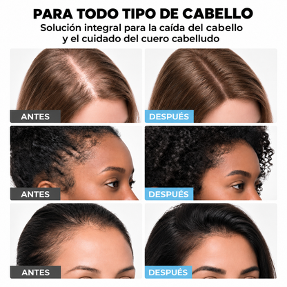 Crema Anticaída Minoxidil 5%