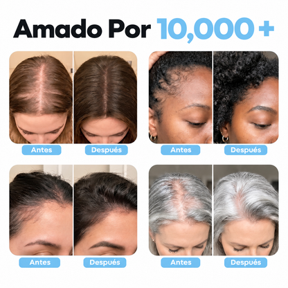 Crema Anticaída Minoxidil 5%